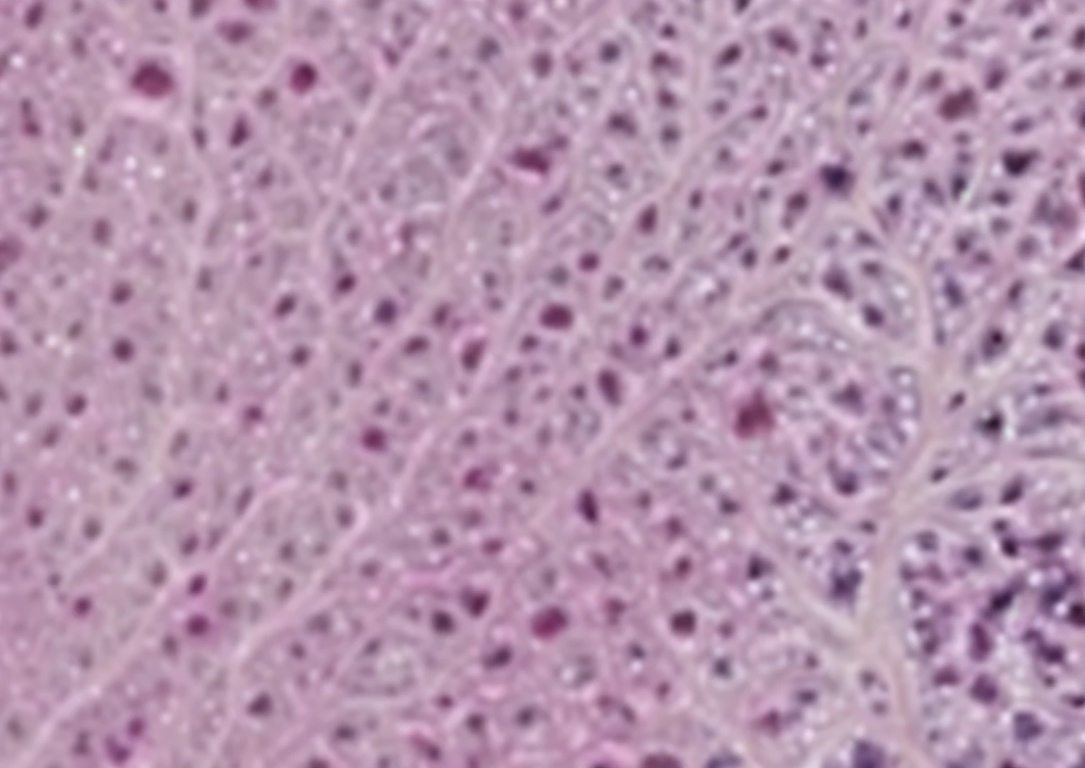 a close up of a piece of skin with small dots, histological, brains, symobolism, pathology, neurons, neuroscience, neurograph, high detail photo, nerve cells, brain visible, neuron, cerebellar peduncle, dendritic, tumors, looking across the shoulder, neural, entire person visible, in the center of the image