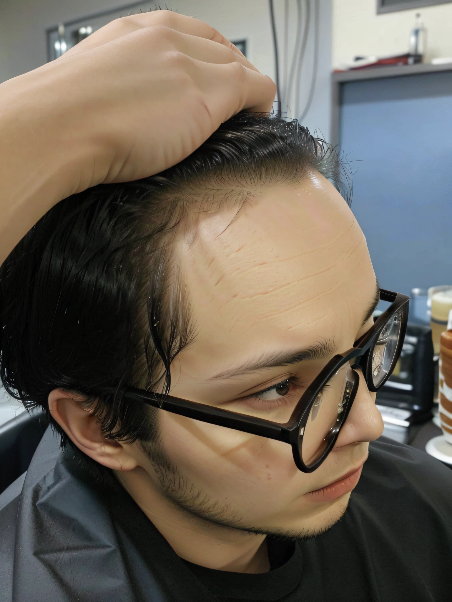 there is a man with glasses and a black shirt getting his hair cut, receding hairline, buzzed hair on temple, short hair on top of his head, growth on head, showing forehead, thin scar on his forehead, bigger forehead, dragon scales across hairline, large forehead, 2 , forehead only, 2 7 years old