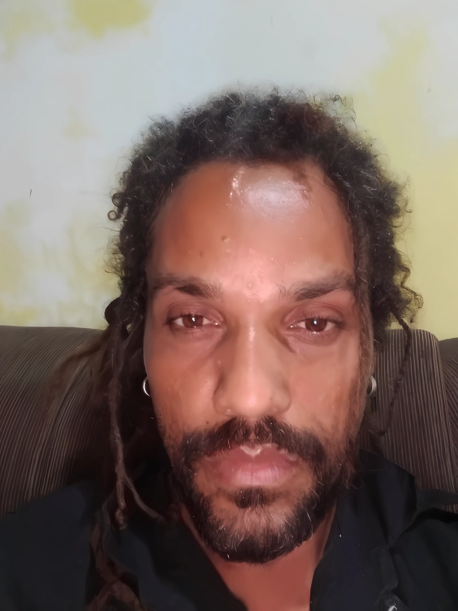 There is a man with dreadlocks sitting on a couch, thin scar on forehead, showing forehead, brown eyes and big forehead, big forehead, lightning scar on forehead, third eye in the middle of forehead, profile picture, wet eye on forehead, third eye in the middle of forehead, wearing a sticker over one eye, visible forehead, help me, profile picture