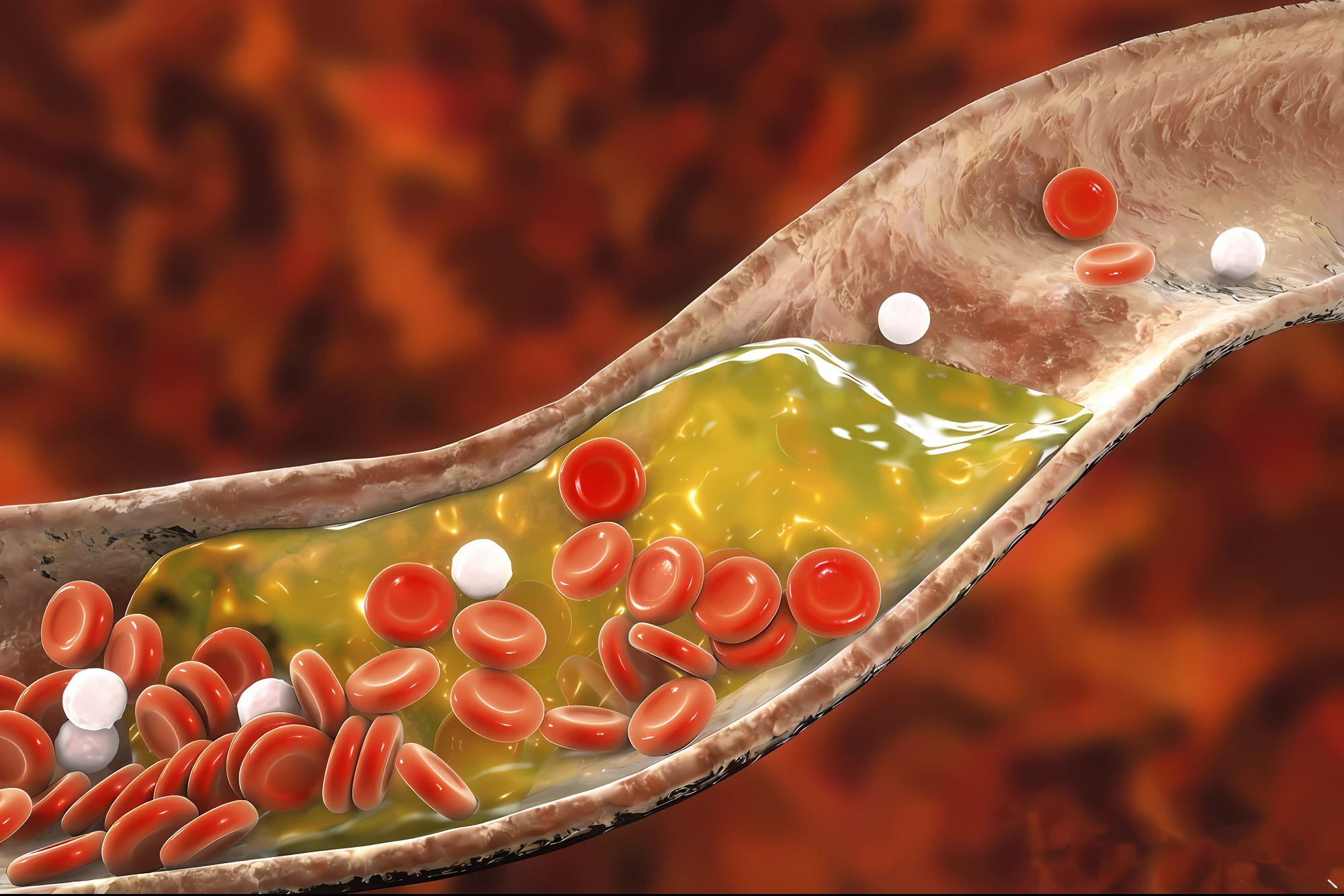 There is a spoon，The spoon was filled with blood and white pills, an illustration of, arteries, Blood, blood corpuscle, 20 small white balls，Blood smear, medical illustration, blood vesels, A illustration, Cytoplasm", Renders, close up photograph, aorta, umbrakinesis, hd illustration, medical depiction, ilustration