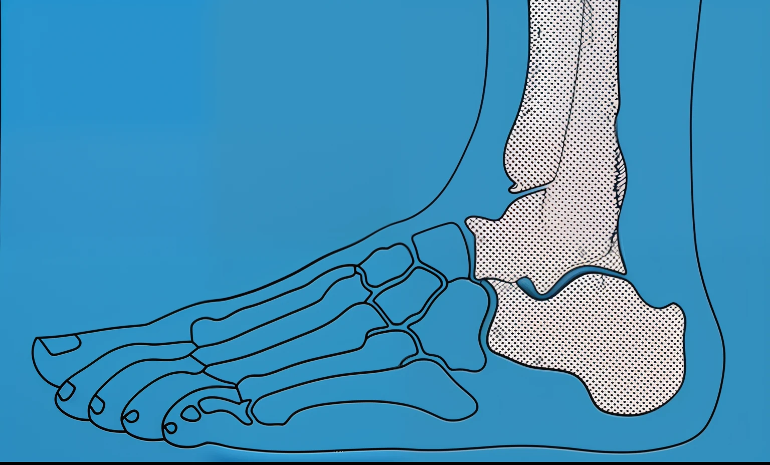 a closeup of a drawing of a foot with a bone, a diagram of the foot with the bones and bones marked, medical illustration, medical depiction, arcos altos, Anatomical, Ossos salientes, medical diagram, simple anatomical, Detailed illustration, anatomic, Ortoview, an illustration of, illustration detailed, Anatomical description, Tendons, irregular, good bone structure, High detail illustration, anatomical diagram, osso