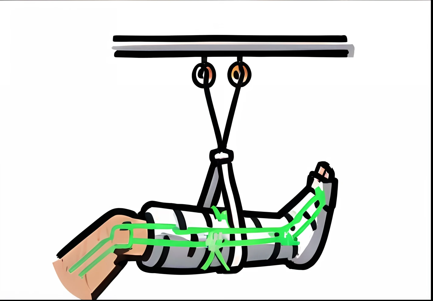 Just show a picture of a leg covered with bandages hang on a traction
