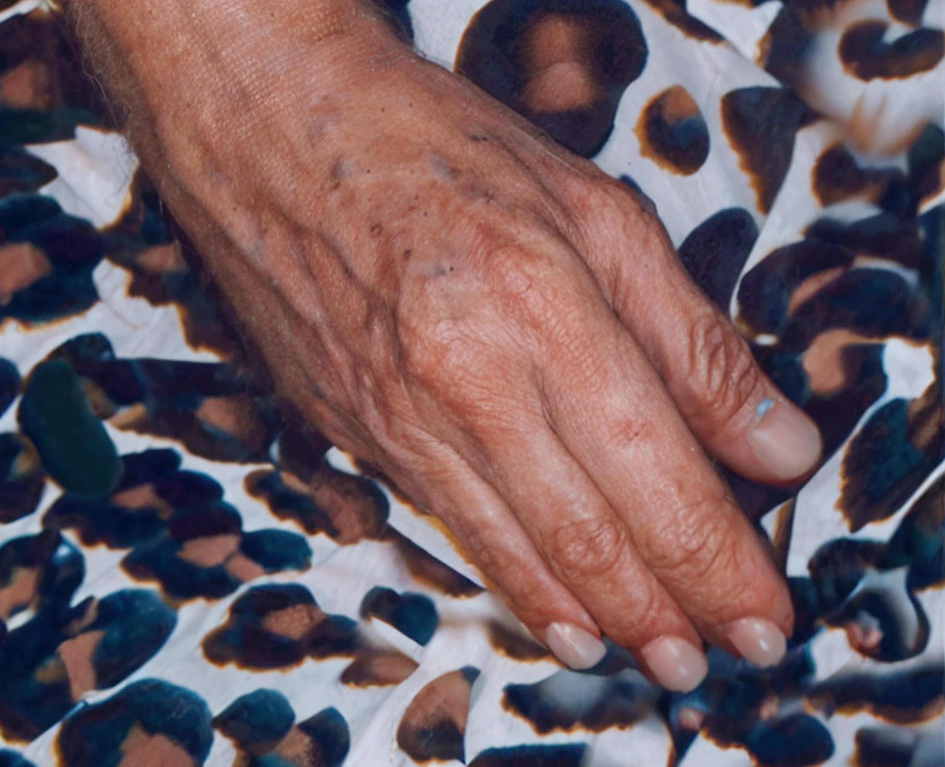 70 year old woman's arm, Hands and fingers of a 70 year old woman, dedos de mulher com unhas