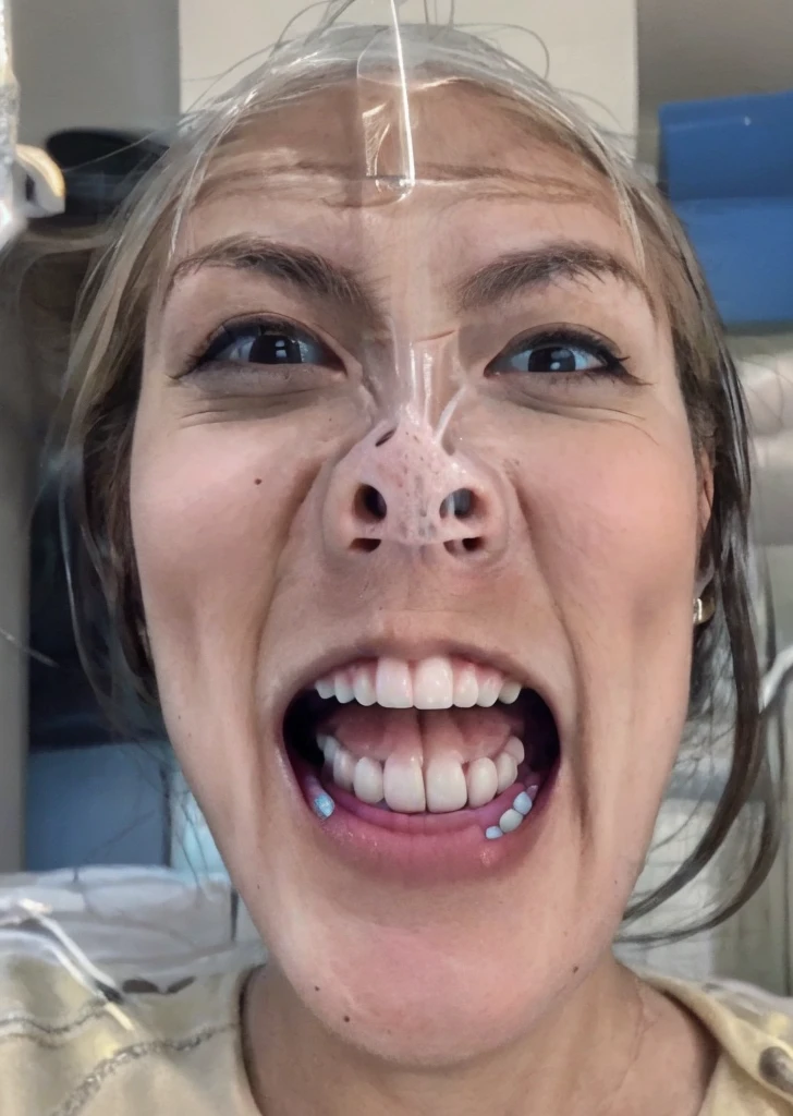 (best quality, Ultradetailed:1), young girl, upper body, front lighting, front pov,open mouth