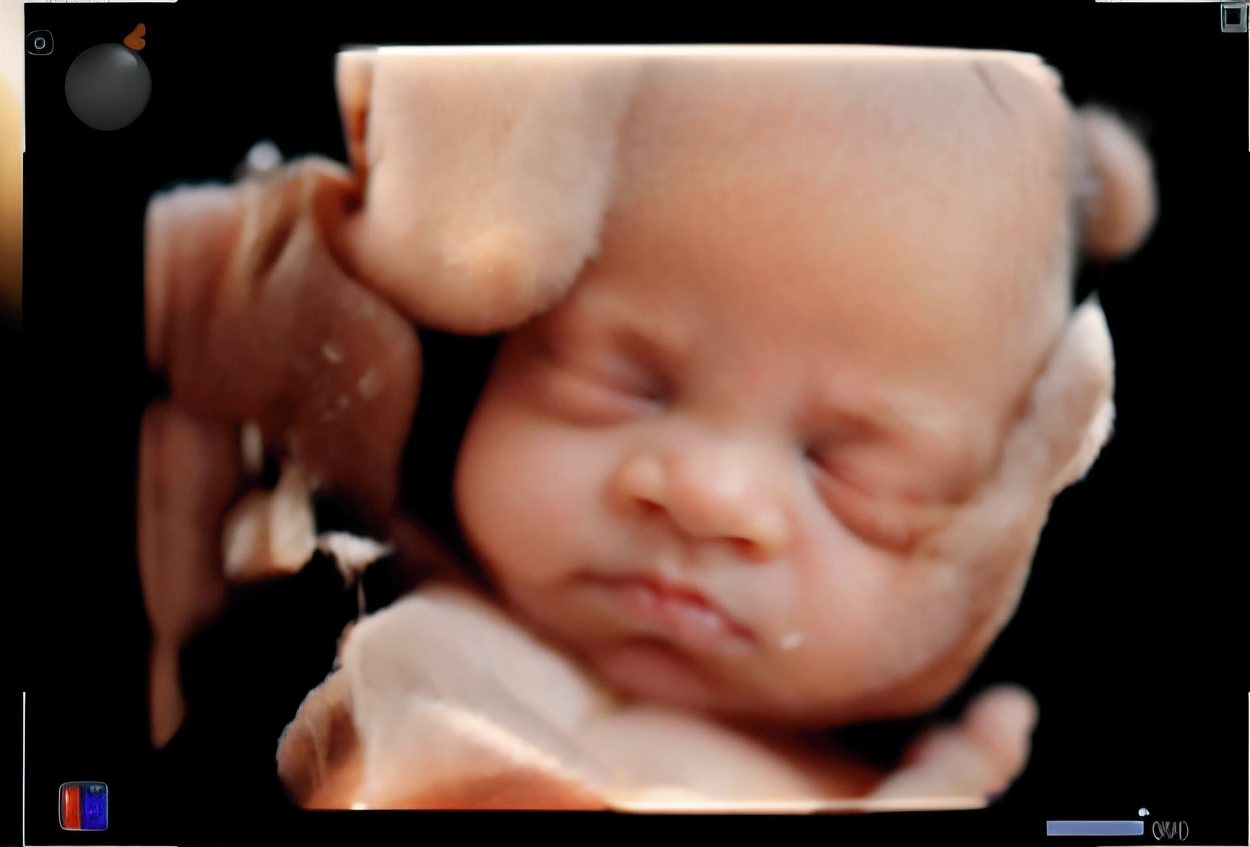 portrait, sleeping baby, inside womb, rosy face, hd, realistic, cute, baby girl, 8k, uhd, high quality, sharp focus, The composition beautiful rich and bright
