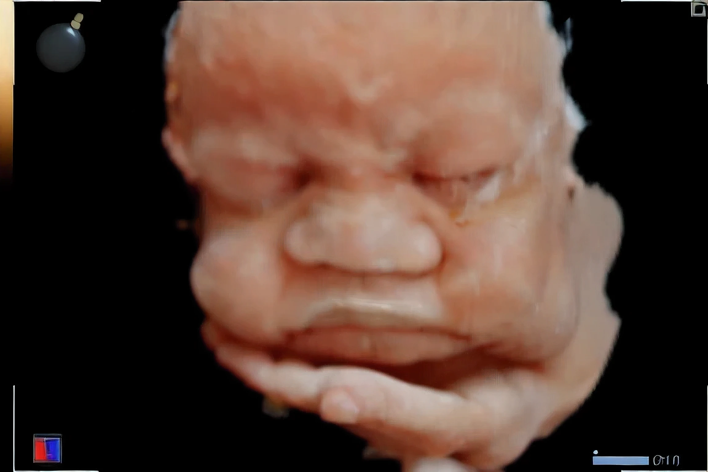portrait, sleeping baby, fetus, inside womb, rosy face, hd, realistic, cute, baby boy, 8k, uhd, high quality, sharp focus, the composition beautiful rich and bright