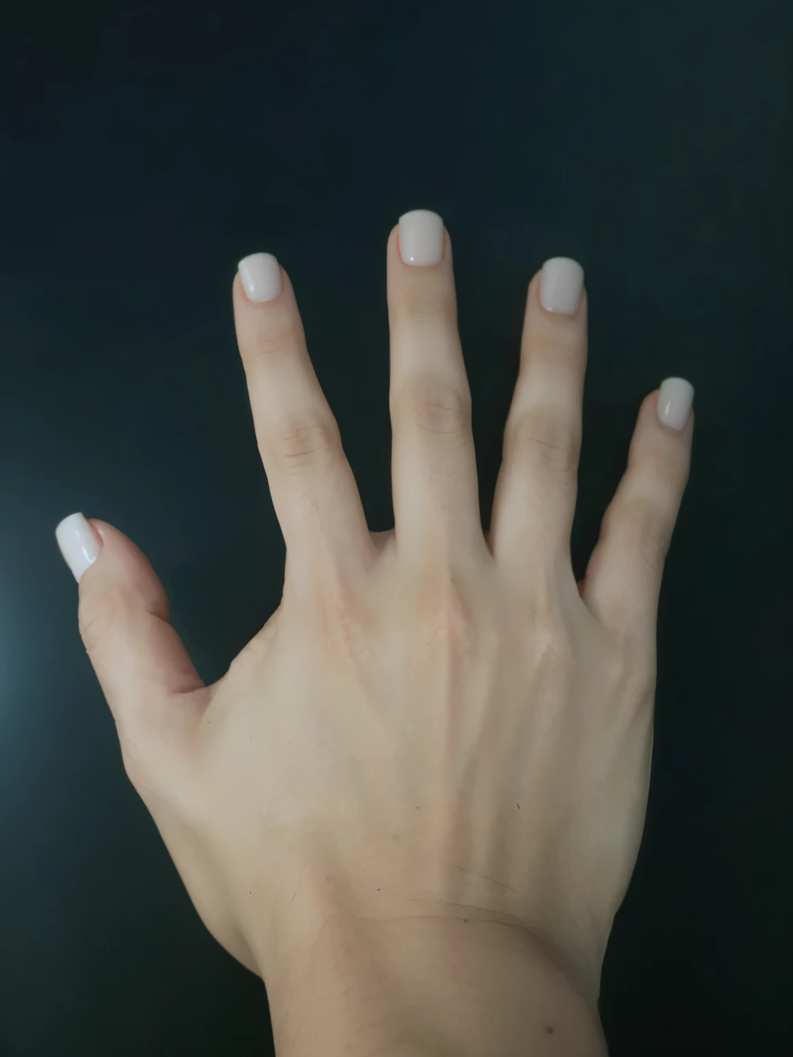Get a professional manicure on that hand 