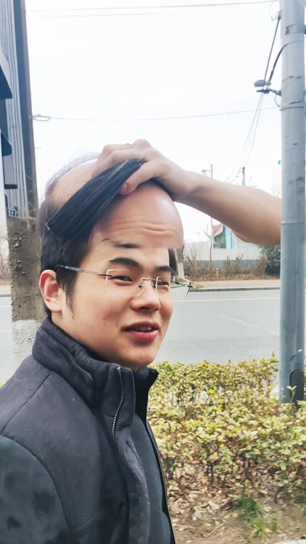 balding