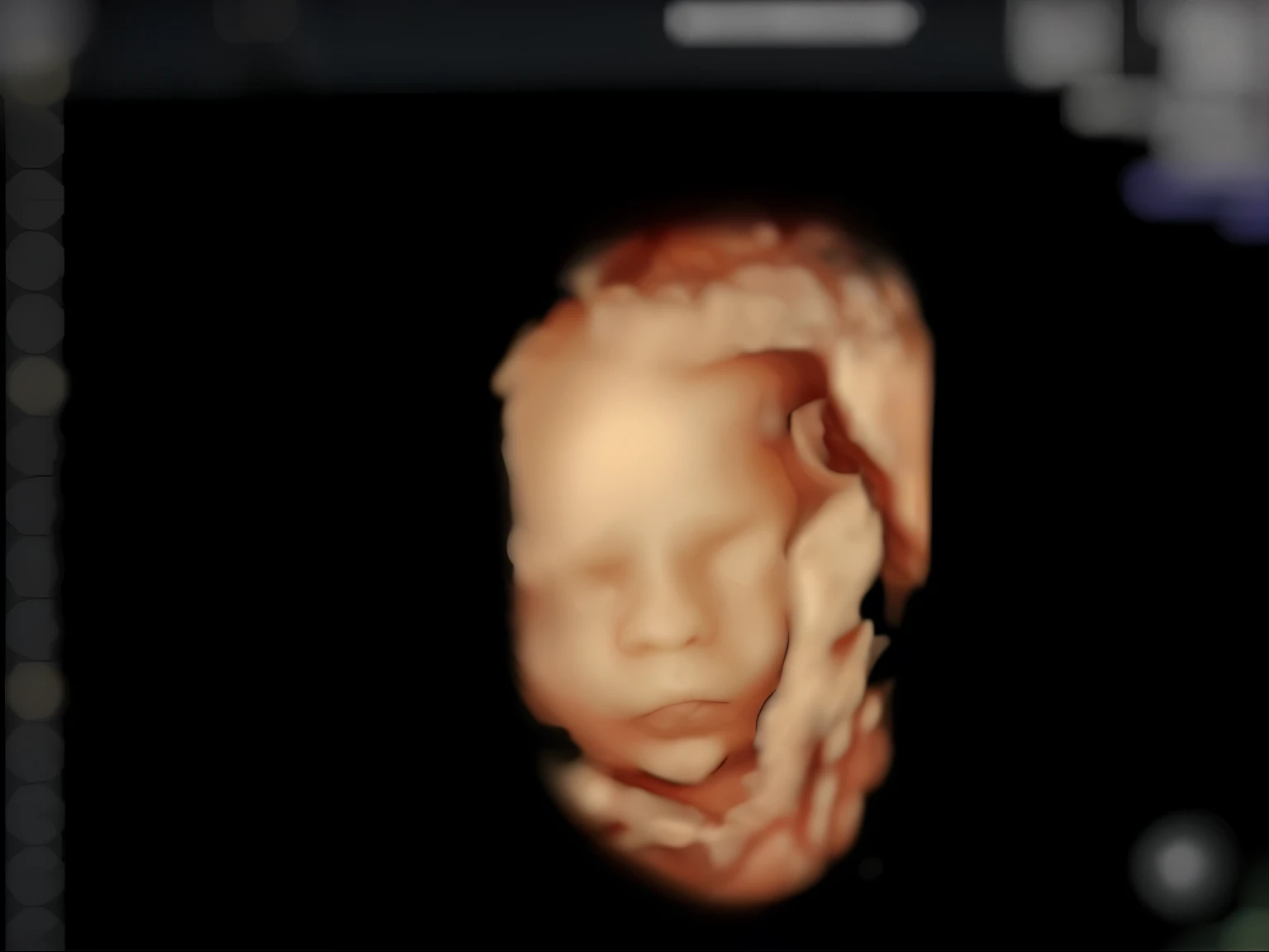  Enhance this 4D ultrasound image of a 27 weeks fetus. Arafed image of a 's face, fetus, high-resolution scan, Very chromatic aberration, extremely high-quality scan, Hyper-realistic simulation, high-quality scan, Bump mapping, High-quality 3D realism, simetry! human fetus, Realistic flesh texture, Heavy JPEG artifact blurred, Highly realistic bump mapping, high-resolution scan. A close-up image of a head with an image of a 27 weeks fetus, high-resolution scan, high-resolution scan, Escaneo 4K, Escaneo 4K, Escaneo HD, fetus, Cerrar - IP shot, Tapa de pantalla, Medical imaging, Highly coherent image, Detailed analysis, screen capture, extremely high-quality scan, 8K scan, 8K scan, Detailed screen capture. face in profile. eyes closed