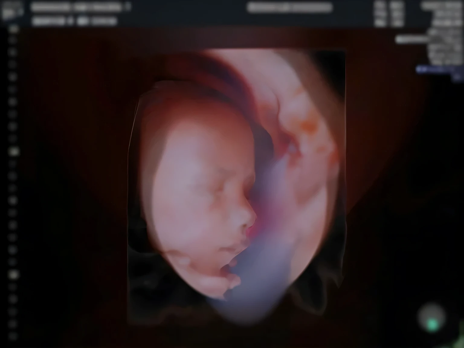 Enhance this 4D ultrasound image of a 22 weeks feto. Arafed image of a baby&#39;s face., feto, high resolution scan, Very chromatic aberration., extremely escaneo de alta calidad, Hyper-realistic simulation, escaneo de alta calidad, Mapeo de relieve, Realismo 3D de alta calidad, symmetry! human feto, textura de carne realista, Artefacto JPEG pesado borroso, Mapeo de relieves altamente realista, high resolution scan. A close-up image of a head with an image of a 22 weeks feto, high resolution scan, high resolution scan, Escaneo 4K, Escaneo 4K, Escaneo HD, feto, Cerrar - IP shot, Tapa de pantalla, Imagenes medicas, Imagen muy coherente, Detailed analysis, la captura de pantalla, extremely escaneo de alta calidad, Escaneo 8K, Escaneo 8K, Detailed la captura de pantalla. cara de perfil. Ojos cerrados