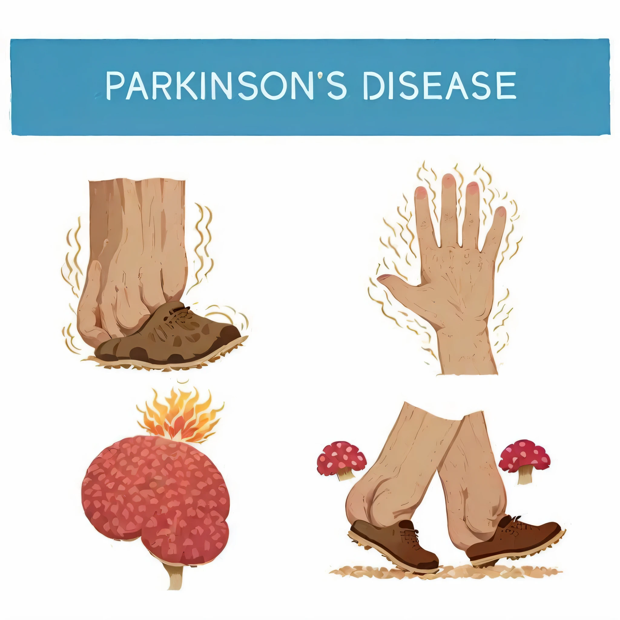 parkinson disease info with hand and brain, disease, illustration], 4l, 8l, 8 l, ( ( illustration, 🤬 🤮 💕 🎀, illustration!, umbrakinesis, ❤🔥🍄🌪, inspired by Keith Parkinson, pp, infographic with illustrations, by Aleksander Gierymski, an illustration of, 🔥 😎 🕹️ 👀