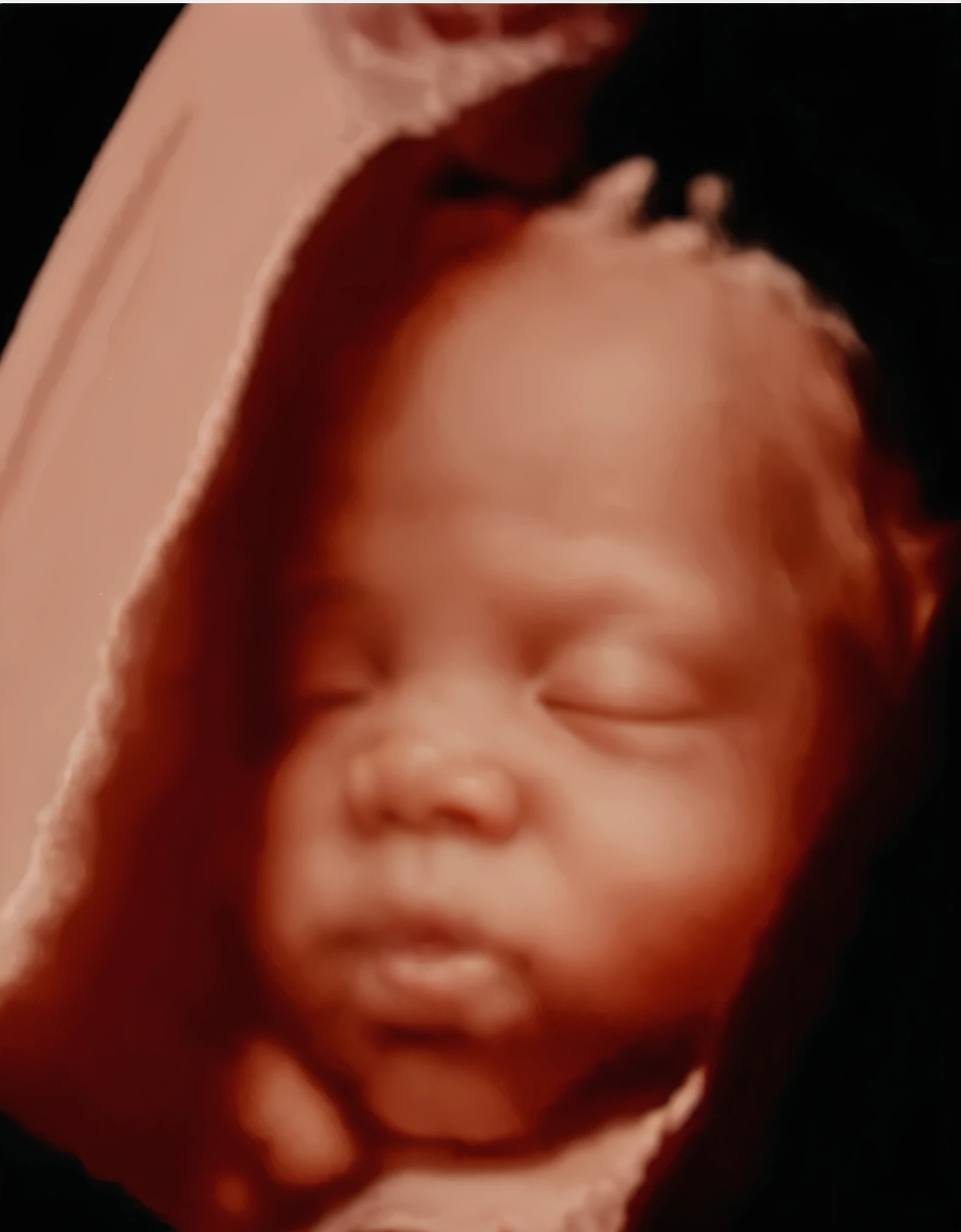 Ultrasound image of a baby sleeping. Improve the resolution and make it like its a photoshoot of a newborn baby with cinematic lighting