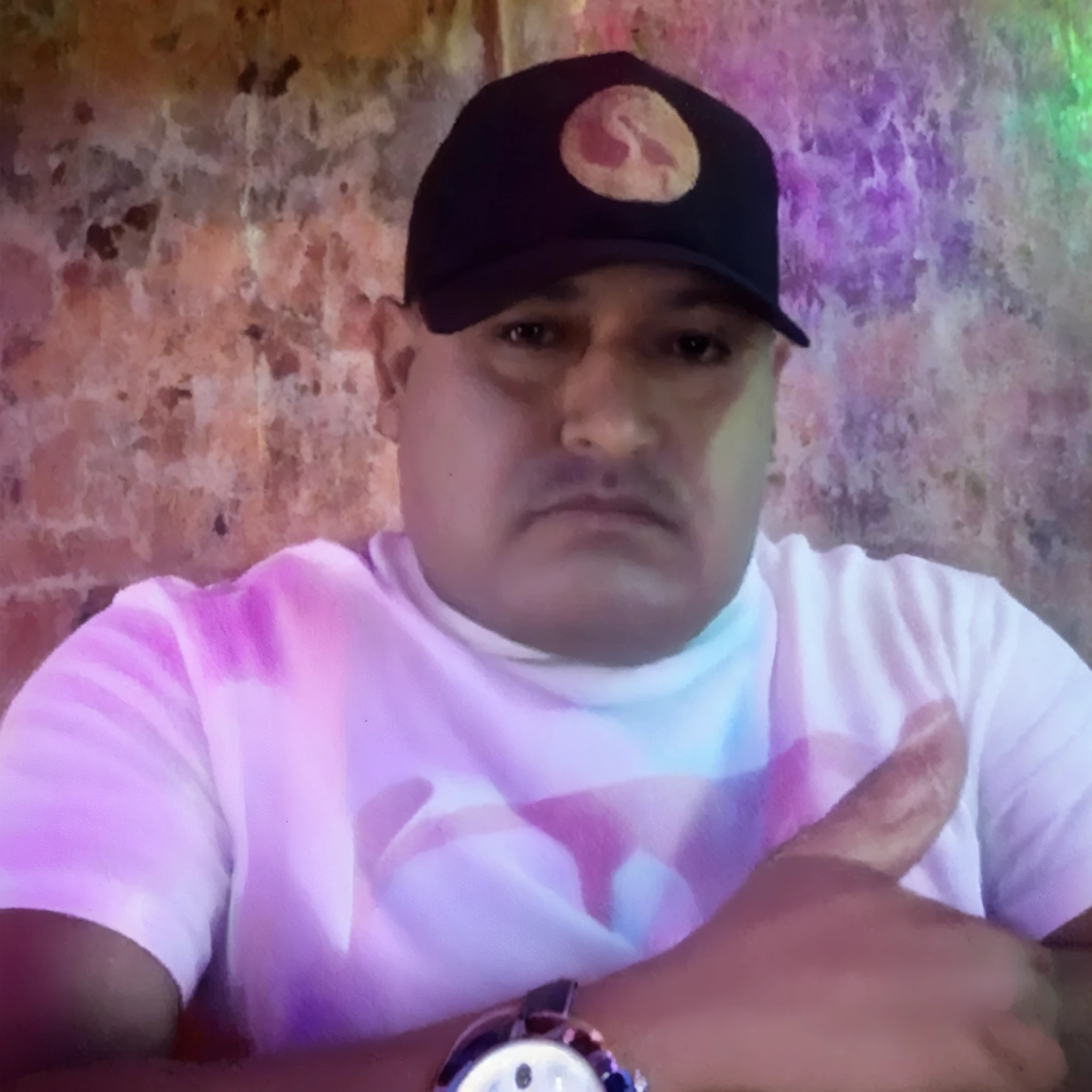 Hombre calvo