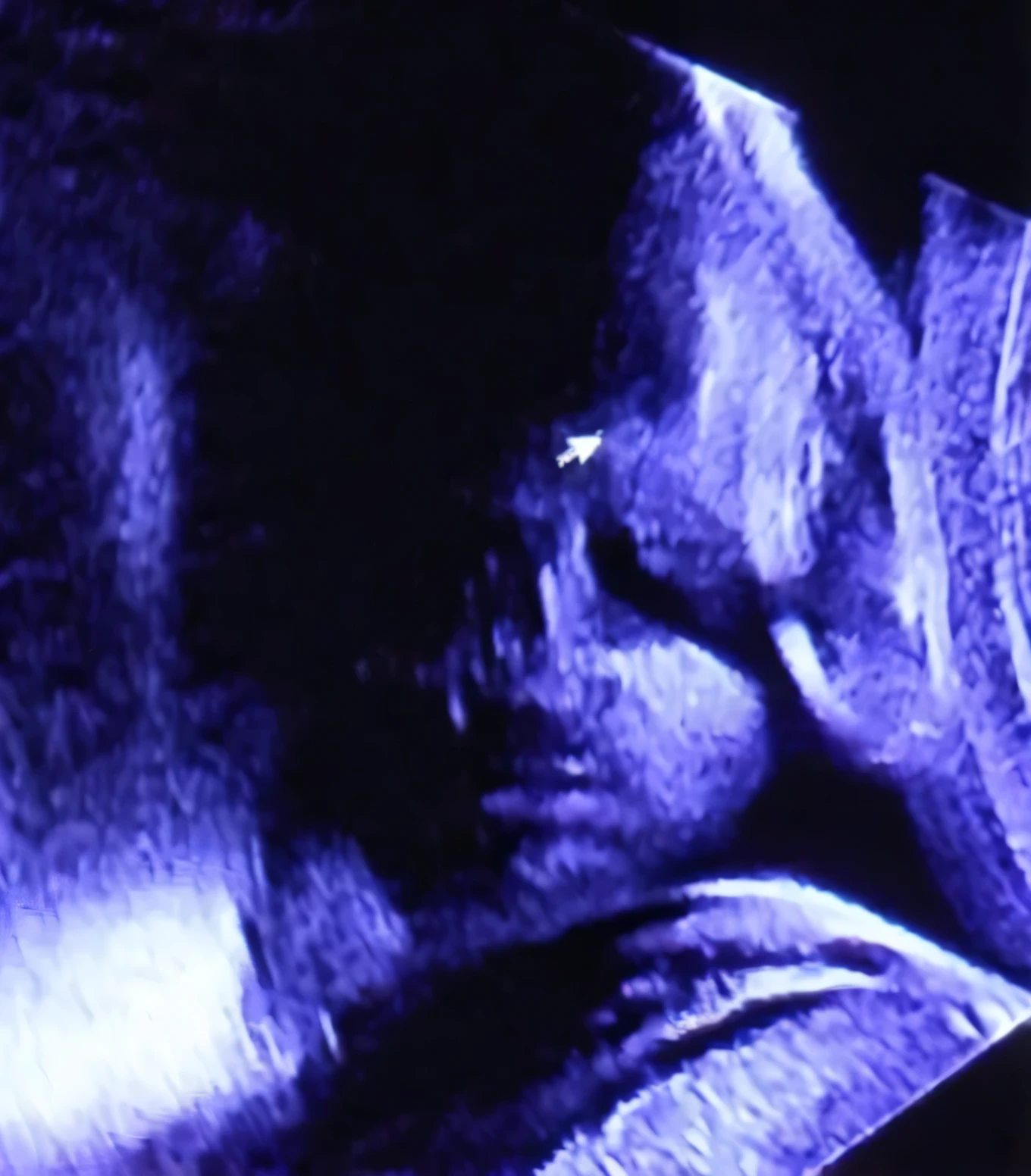Based on the features of this ultrasound, recrie a imagem melhorando a qualidade. 