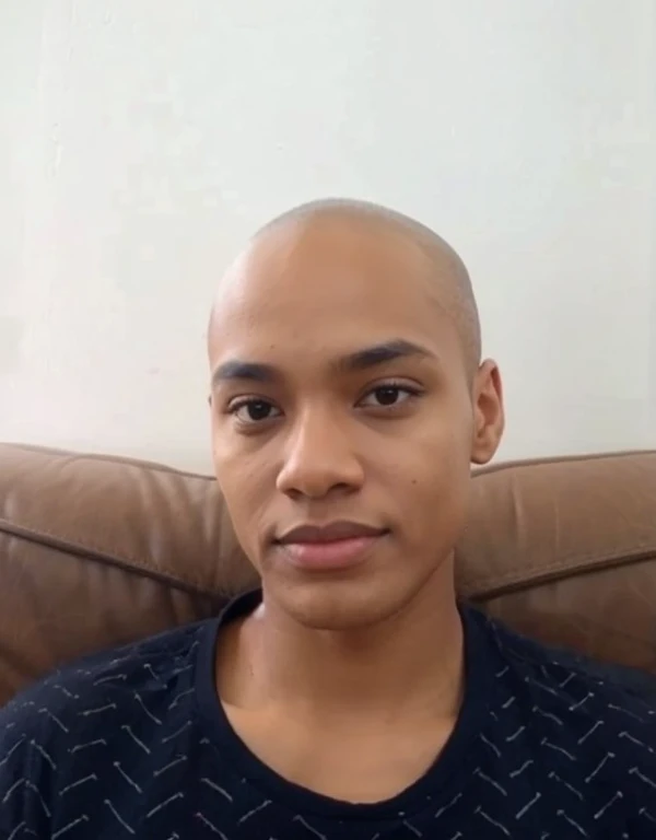 With black skin
