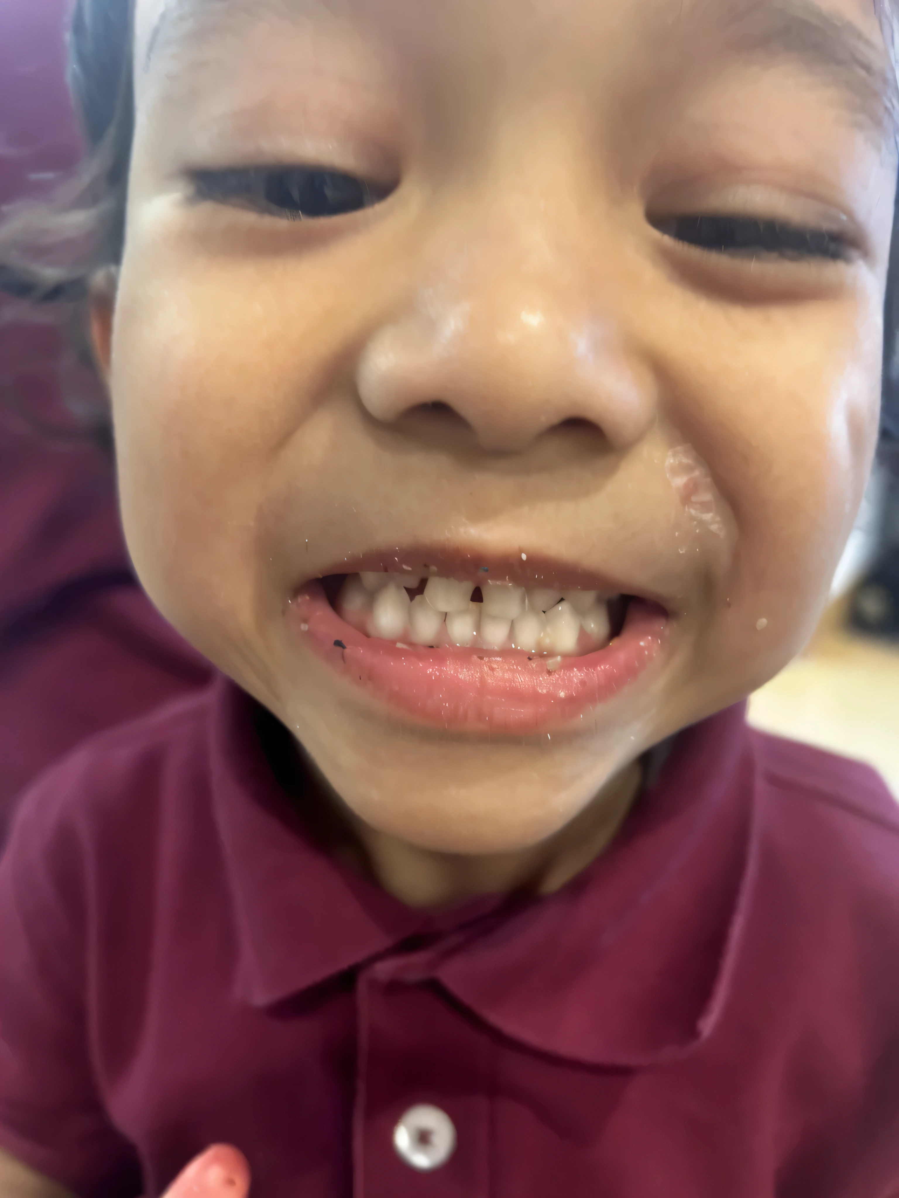 arafed  with a tooth missing and a missing tooth, small wide smile, no teeth, teeth filled with cavities, closed mouth showing no teeth, drooling teeth bared, holes in the lower jaw, detailed smile, big gash on face, closeup. mouth open, a plaster on her cheek, broken teeth, round teeth and goofy face, detailed mouth