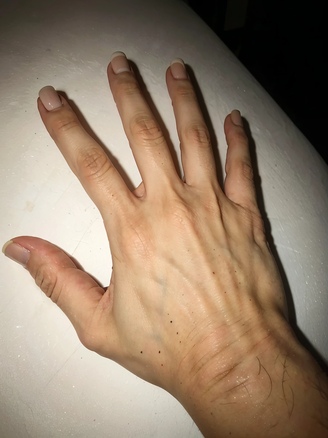 photo of a boy's hand with veins, wearing a black bracelet