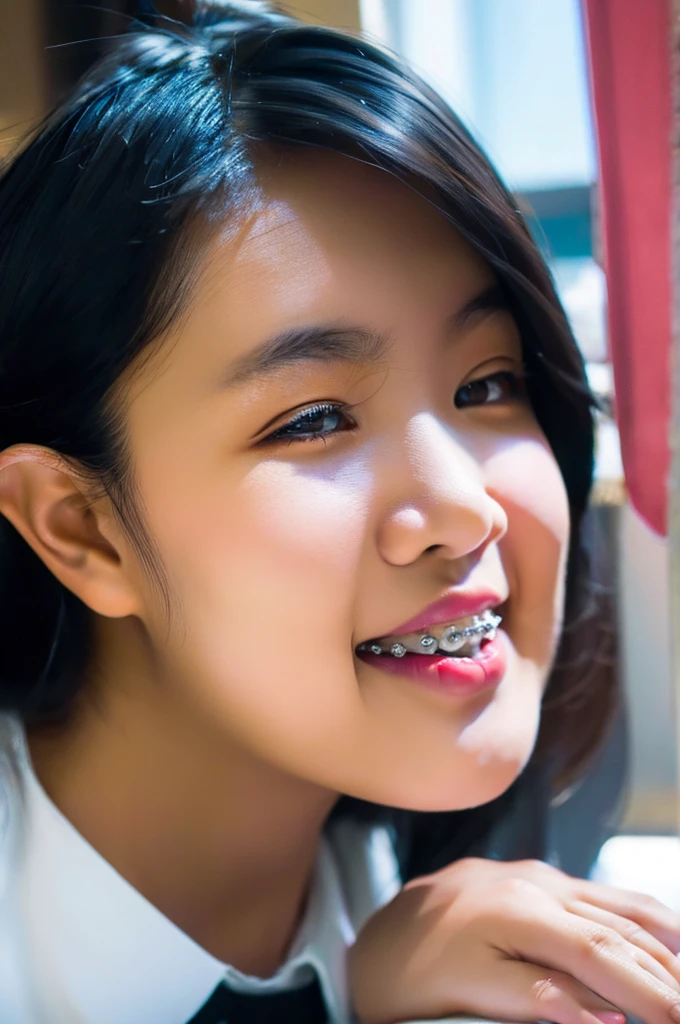 asian girl with braces close up on braces with power chain