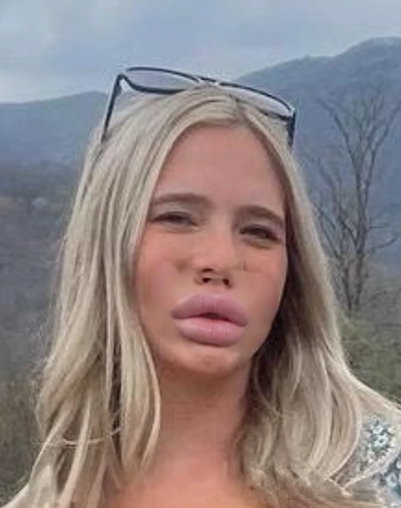 Large plump Bimbo lips, match face features, match lip color, match skin, match lighting, super realistic
