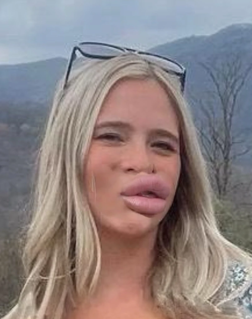 Large plump Bimbo lips, match face features, match lip color, match skin, match lighting, super realistic