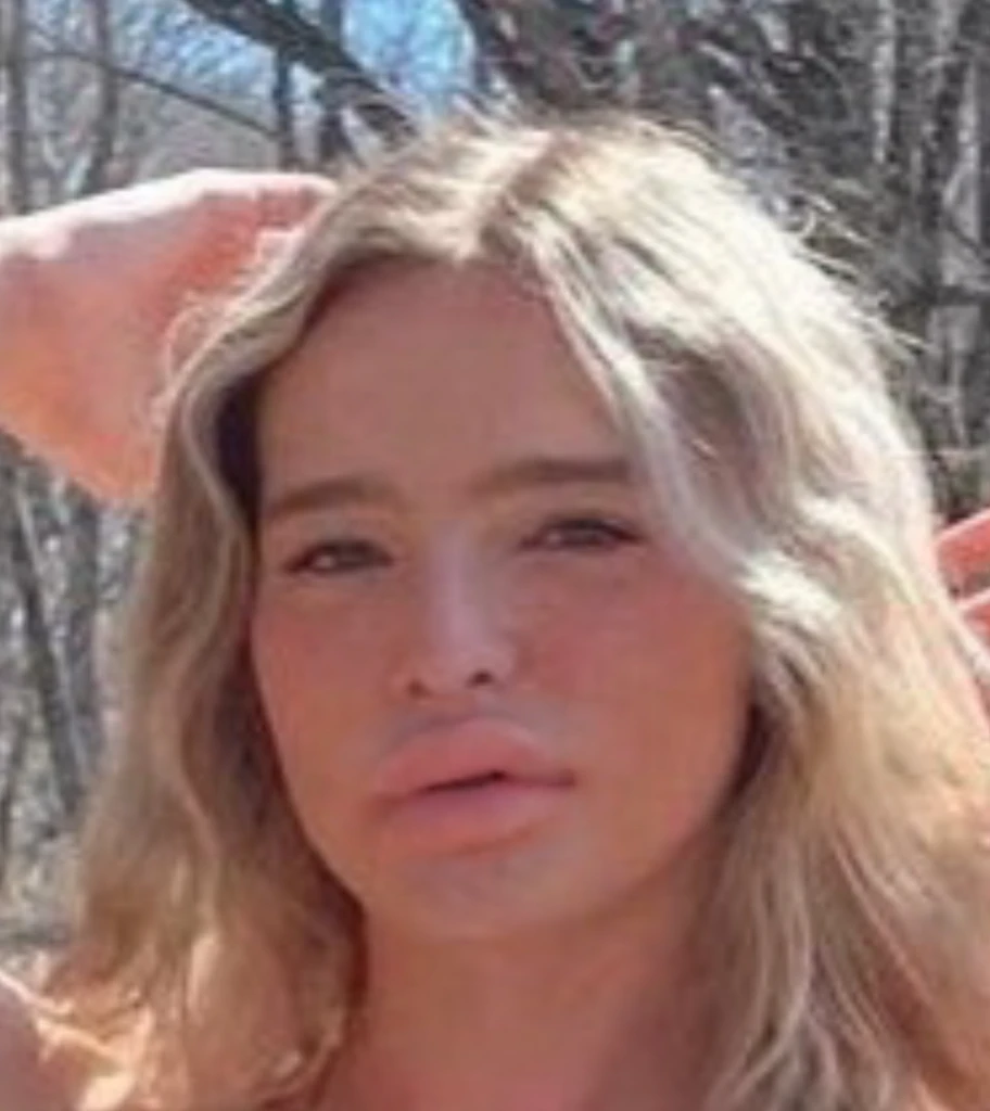 Large plump Bimbo lips, match face features, match lip color, match skin, match lighting, super realistic