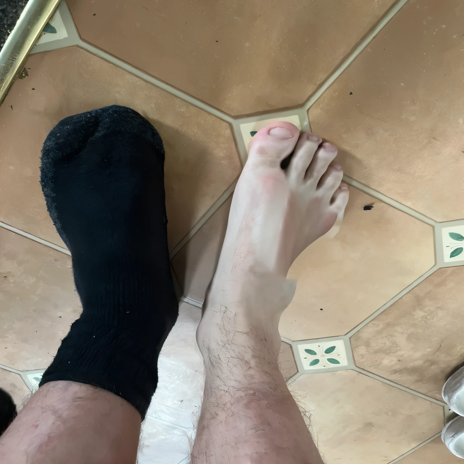Swollen foot, sore and red skin 
