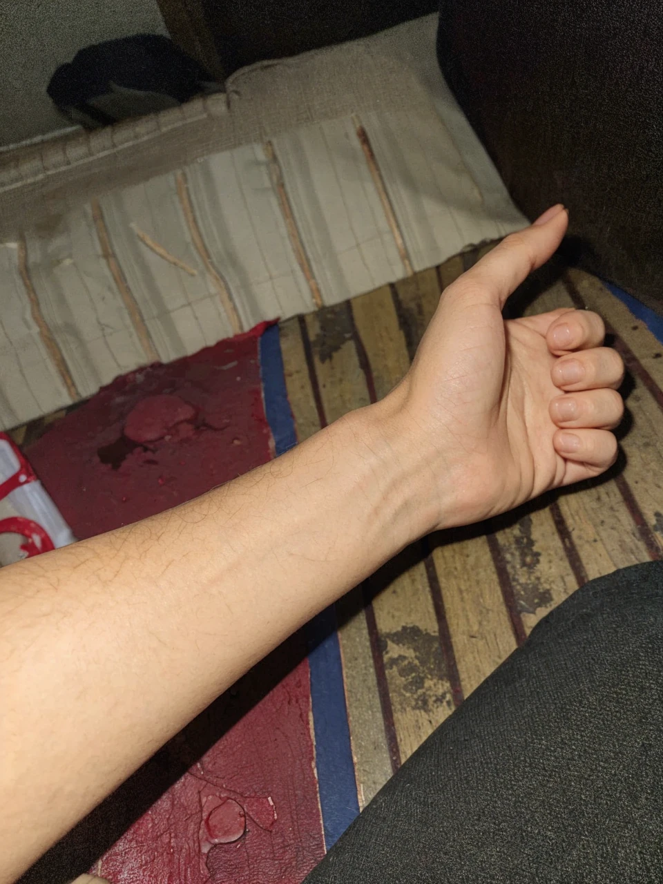 Hand
cutting and so many blood