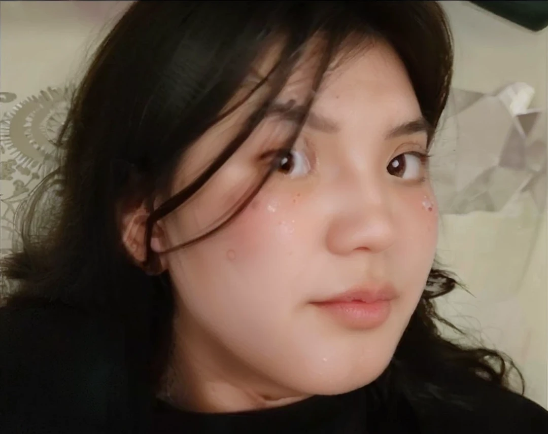 Crystal ball version mix crystalm3lody asian chin round chin pimples cover