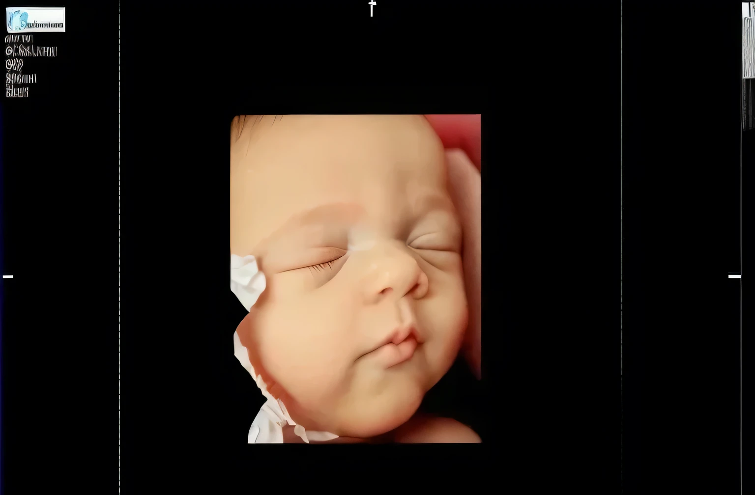 fix chin