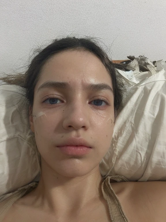 create a photo using this model with bandages on the rest and swollen eyes and little purple