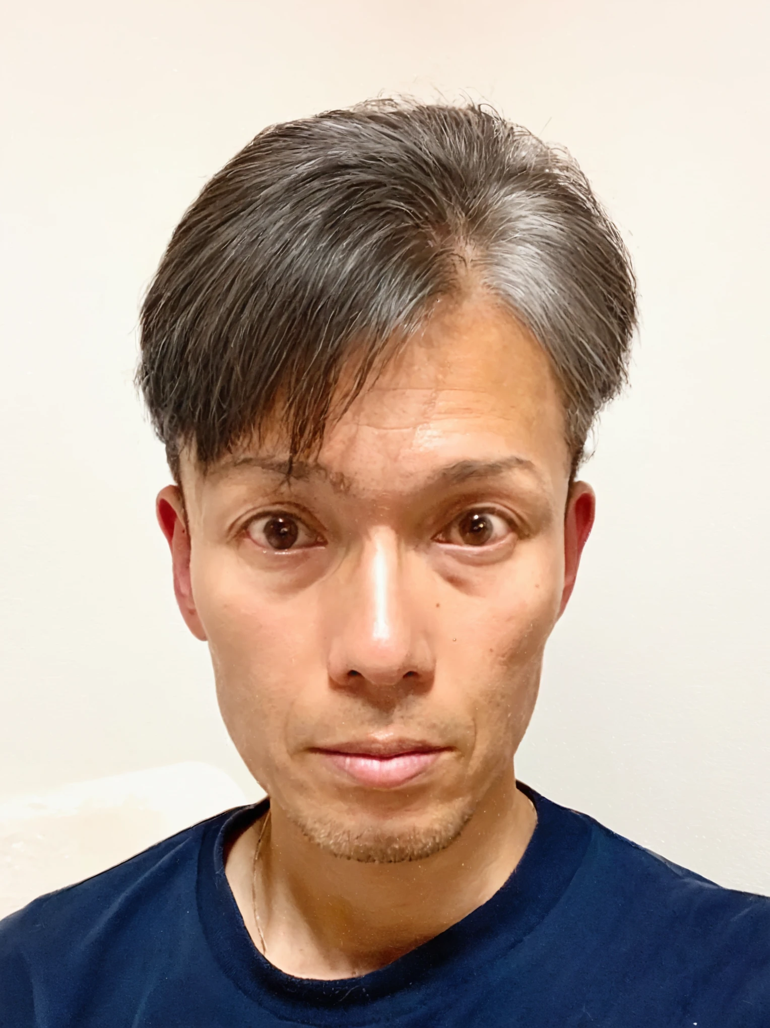 Gray Hair, Thinning hair