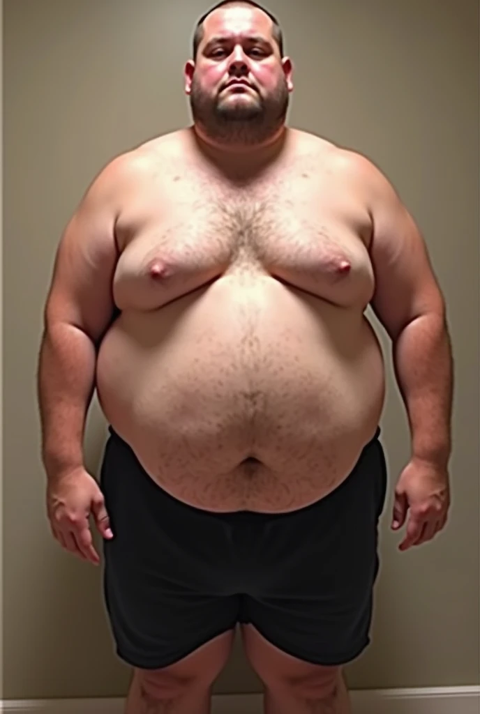  I want to see a before and after of the penis size of an obese person who has now lost a lot of weight
