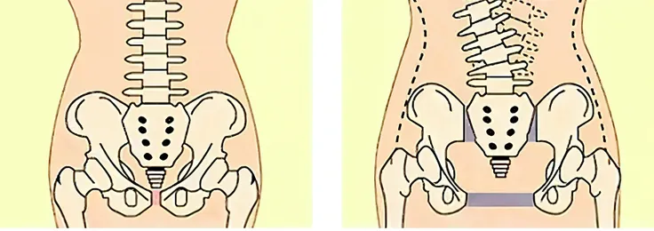 coccyx bone