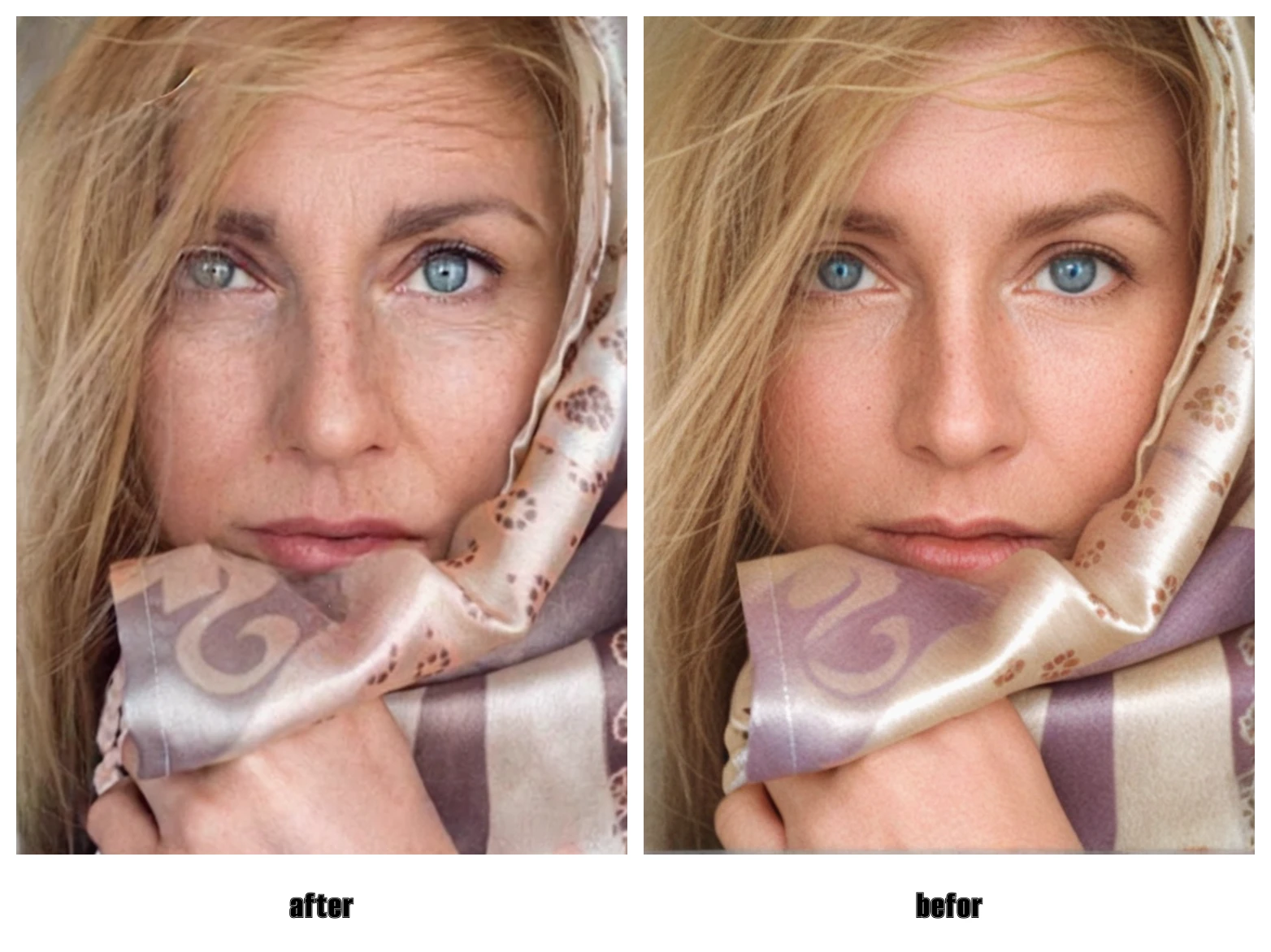 One-click beauty, easily remove facial issues!