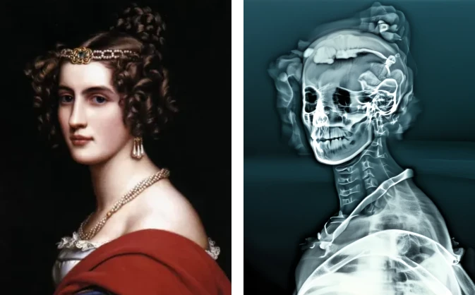 Transform your image like an X-ray and bring a unique see-through vibe to images.