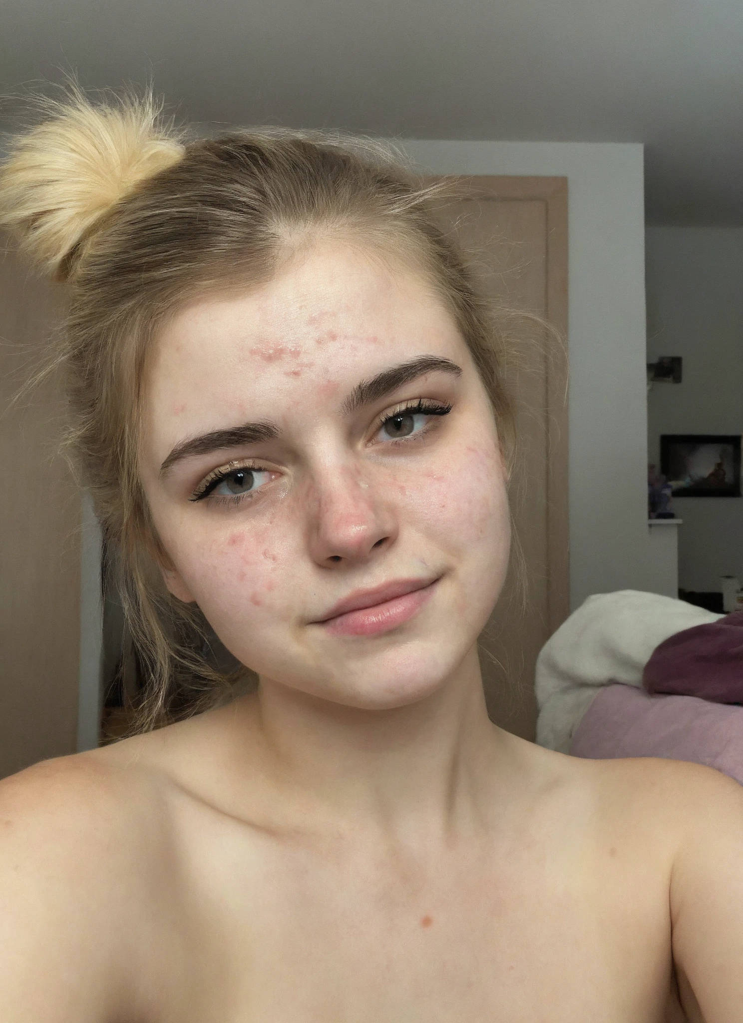 front view, selfie picture of a blonde girl in her 20s, emotionless, wearing black hoodie, portrait photo, Detailed natural skin and acne
