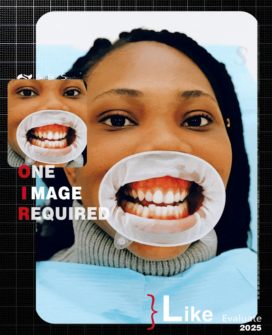 PLK 2.0 📌Teeth Whitening Correction🚩