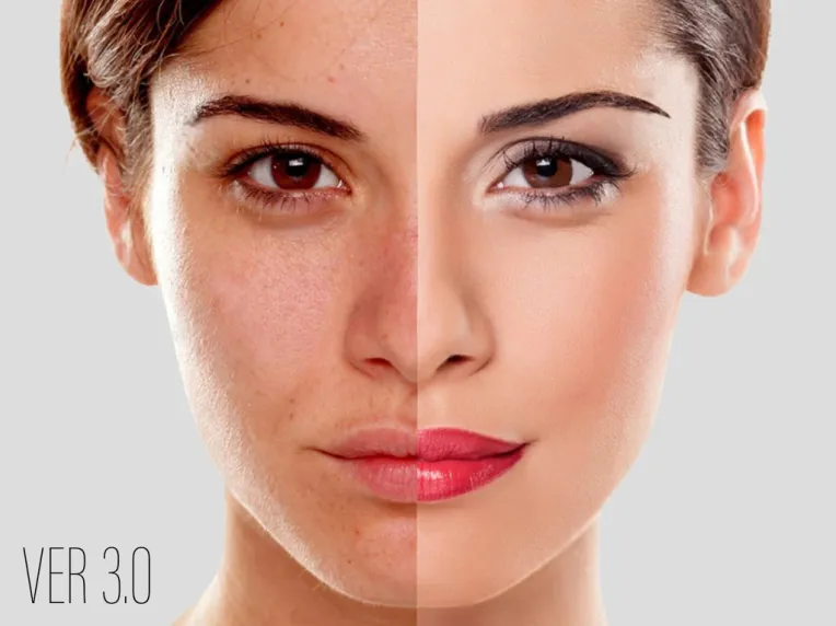 Phiên bản Easy retouch FLux