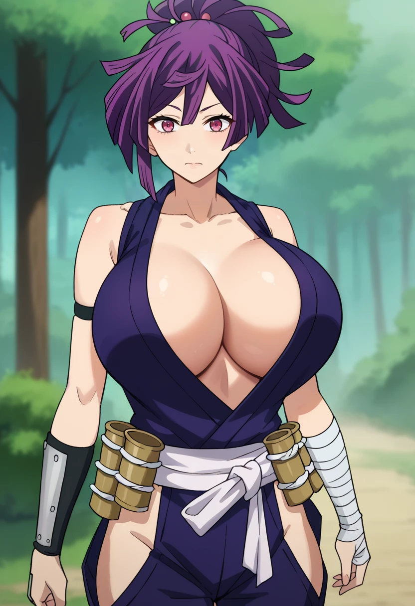 Breast Implants - PonyXL