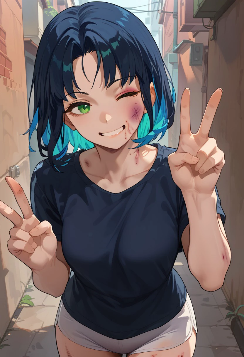 Bruises [PONY] V1