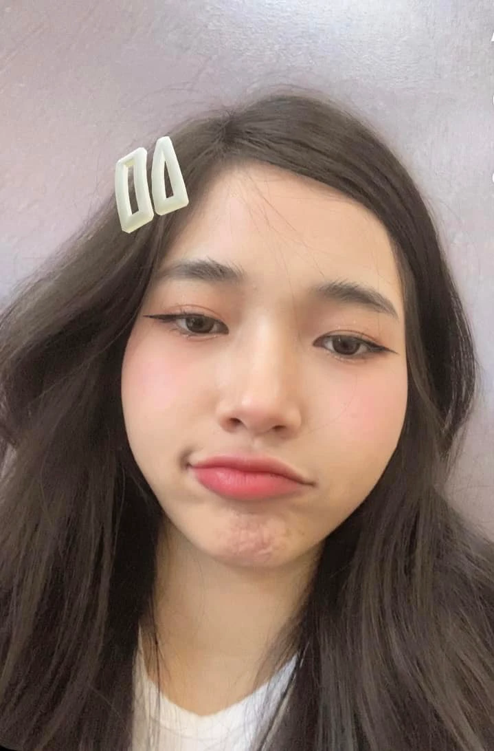 nampet dio 1