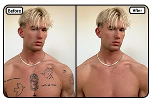 remover objeto da imagem para redes sociais