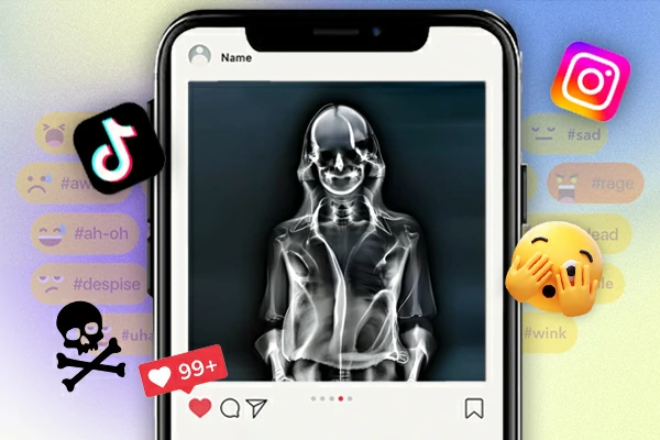Share X-ray photo effect online