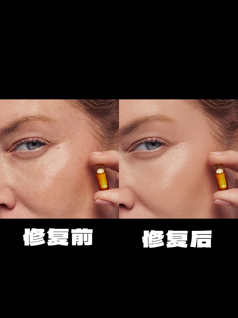 Smooth skin