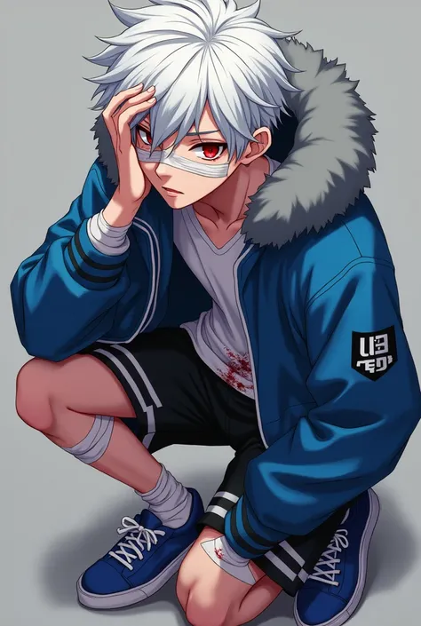  A 17-year-old anime boy with white hair and red eyes wearing a blue jacket,  black shorts with white stripes , white shirt and blue sneakers .  Your shirt is stained with blood ,  the jacket is a different shade of blue and the hood has gray fur ,  has ba...