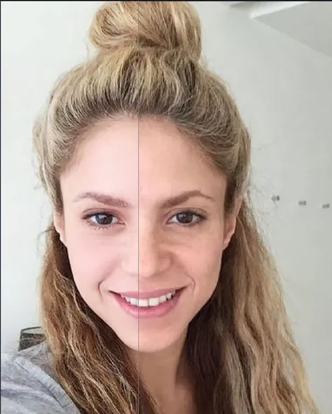 Một nếp nhăn làm đẹp chính, đầy đặn trên khuôn mặt, tạo tác làm đẹp