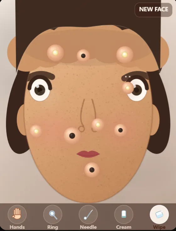 Popping pimples T